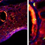 Study: A bad bout of flu triggers ‘taste bud cells’ to grow in the lungs — (Details)