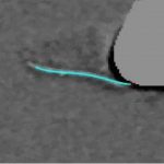 Study: They also find a surprise about cilia synchronization — or lack thereof — (Details)