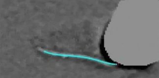 Study: They also find a surprise about cilia synchronization — or lack thereof — (Details)