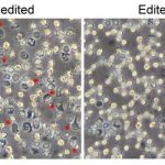 Study: New strategy for editing blood stem cells is more efficient and targeted — (Details)