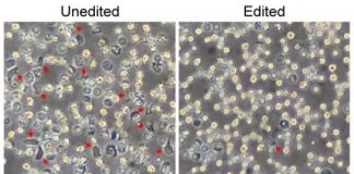 Study: New strategy for editing blood stem cells is more efficient and targeted — (Details)