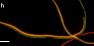 Study: Anti-evolvability drugs could slow antibiotic resistance in bacteria — (Details)