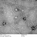 Study: New discoveries on bacterial viruses — (Details)