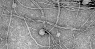 Study: New discoveries on bacterial viruses — (Details)