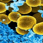 Study: Evidence for link between ‘leaky gut’ and autoantibody production in HIV-positive patients — (Details)