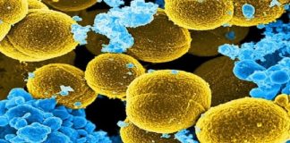 Study: Evidence for link between ‘leaky gut’ and autoantibody production in HIV-positive patients — (Details)