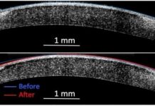 Research: ‘Molecular surgery’ reshapes living tissue with electricity but no incisions —