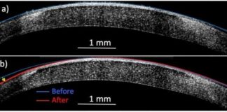 Research: ‘Molecular surgery’ reshapes living tissue with electricity but no incisions —