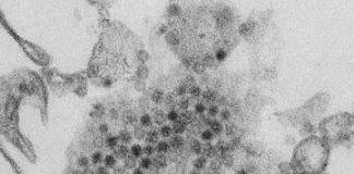 Study: Acute flaccid myelitis requires galvanized research response — (Details)