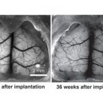 Study: Device could provide new insight for brain research on concussions, Alzheimer’s and Parkinson’s — (Details)