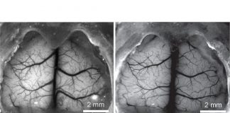 Study: Device could provide new insight for brain research on concussions, Alzheimer’s and Parkinson’s — (Details)