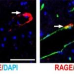 Study: Elucidation of functional mechanism of ‘love hormone,’ oxytocin, at molecular level — (Details)