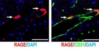Study: Elucidation of functional mechanism of ‘love hormone,’ oxytocin, at molecular level — (Details)