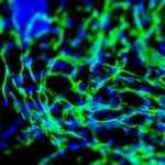 Study: Creating blood vessels on demand — (Details)