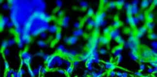 Study: Creating blood vessels on demand — (Details)