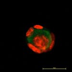 Study: A step toward recovering reproduction in girls who survive childhood cancer — (Details)