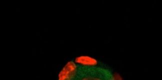 Study: A step toward recovering reproduction in girls who survive childhood cancer — (Details)