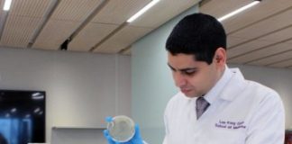 Study: Lung disease bronchiectasis associated with high frequency of allergy — (Details)