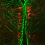 Study: Parkinson’s clues seen in tiny fish could aid quest for treatments — (Details)