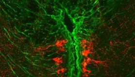 Study: Parkinson’s clues seen in tiny fish could aid quest for treatments — (Details)