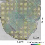 Study: The new findings offer potential avenues for developing therapies for amyotrophic lateral sclerosis — (Details)