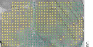 Study: The new findings offer potential avenues for developing therapies for amyotrophic lateral sclerosis — (Details)