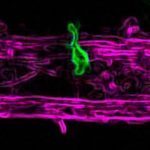 Study: Microglia, cells thought restricted to central nervous system, are redefined in new study — (Details)