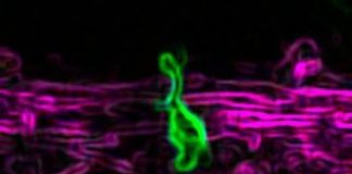 Study: Microglia, cells thought restricted to central nervous system, are redefined in new study — (Details)