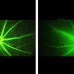 Study: Experiments show new therapy slows blood vessel leakage associated with diabetic macular edema and macular degeneration — (Details)