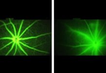 Tech: Individual 2D phosphorene nanoribbons made for the first time — (Report)