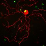 Study: Active lifestyles may help nerves to heal after spinal injuries — (Details)