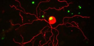 Study: Active lifestyles may help nerves to heal after spinal injuries — (Details)