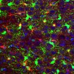 Study: Study uses cell-by-cell analyses to look for new therapies that might work — (Details)