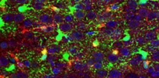 Study: Study uses cell-by-cell analyses to look for new therapies that might work — (Details)