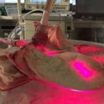 Study: Biophotonic therapy eliminates bacteria and viruses from organs before transplantation — (Details)