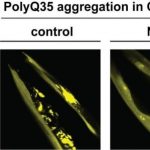 Study: Protein complex may help prevent neurodegenerative diseases — (Details)