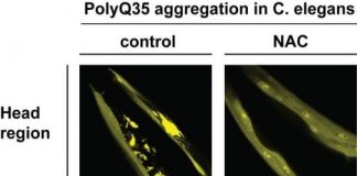 Study: Protein complex may help prevent neurodegenerative diseases — (Details)