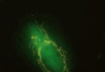 Research: Broken mitochondria use ‘eat me’ proteins to summon their executioners —