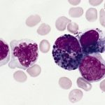 Study: Researchers combine CRISPR gene-editing technology with drug discovery to understand why treatment works (or doesn’t) — (Details)