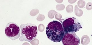 Study: Researchers combine CRISPR gene-editing technology with drug discovery to understand why treatment works (or doesn’t) — (Details)