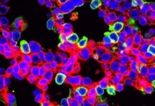 Research: Researchers use gene editing with CRISPR to treat lethal lung diseases before birth —