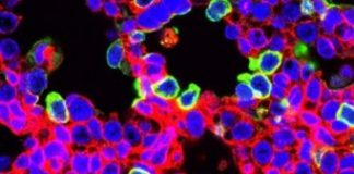 Research: Researchers use gene editing with CRISPR to treat lethal lung diseases before birth —