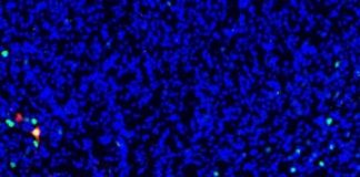 Study: After 170 years, nobody was quite sure where anesthesia worked on the brain — (Details)