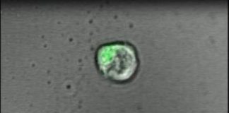 Study: Scientists advance creation of ‘artificial lymph node’ to fight cancer, other diseases — (Details)