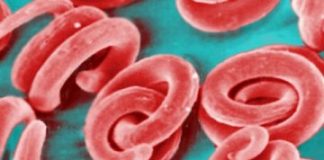 Study: New immune pathway involved in resistance to parasite worms found in undercooked pork — (Details)