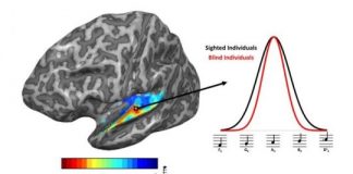 Study: Brains of blind people adapt to sharpen sense of hearing, study shows — (Details)