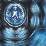 Study: Scientists propose new theory on Alzheimer’s, amyloid connection — (Details)