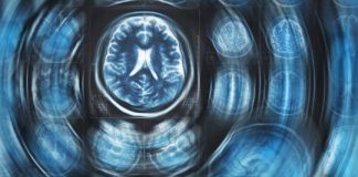 Study: Scientists propose new theory on Alzheimer’s, amyloid connection — (Details)