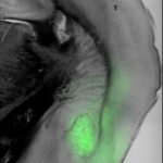 Study: Stressed, anxious? Ask the brain! (Details)