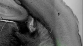 Study: Stressed, anxious? Ask the brain! (Details)